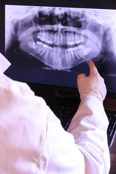 Best Emergency Treatment for Dental Infections or Abscesses in Leadville, CO